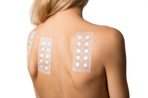 What is T.R.U.E. Test patch testing and How Can It Affect My Allergies? 