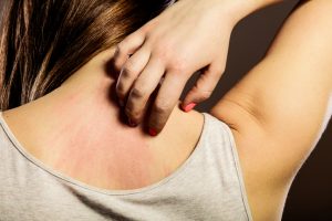 There Are Many Types of Skin Allergies and Many Treatment Options 