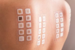 The Truth About Allergy Skin Testing: Can It Help You Find Relief?