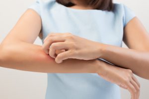 The 6 Most Common Types of Allergies California Residents Experience