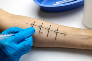 Is it Time for You to See an Allergist? These Signs Point to Yes