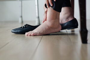 You Don’t Have to Simply Accept Your Swelling Disorder: Learn What Can Be Done