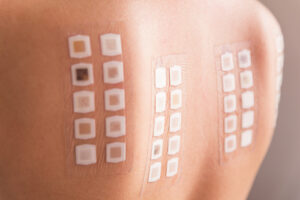 36 Possible Allergies We Can Test For – Learn More About What They Are